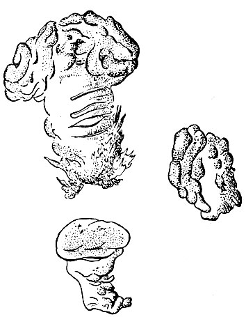 Рис. 3. Плодовые тела миксобактерий (Archangium thaxteri)