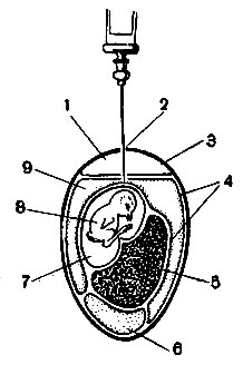 Рис. 46. Метод заражения куриного эмбриона. Заражение в аллантоисную полость куриного эмбриона: 1 - воздушное пространство; 2 - отверстия в скорлупе; 3 - скорлупная оболочка; 4 - хорион-аллантоисная оболочка; 5 - желточный мешок; 6 - белок; 7 - амнион; 8 - плод; 9 - аллантоисная полость