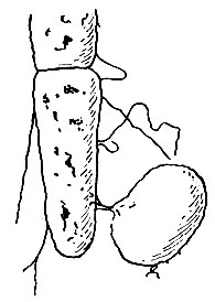 Рис. 48. Электронная микрограмма конъюгации кишечной палочки