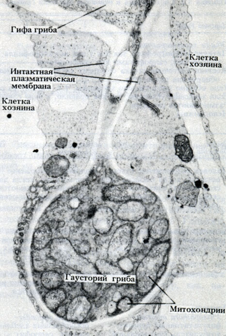 . 3.3.   Albugo Candida,  Cardamine hirsuta.     ''       .   Phytophthora,     Oomycota. x 16575