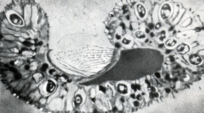  22.    Paramecium bursaria.      -   Chlorella
