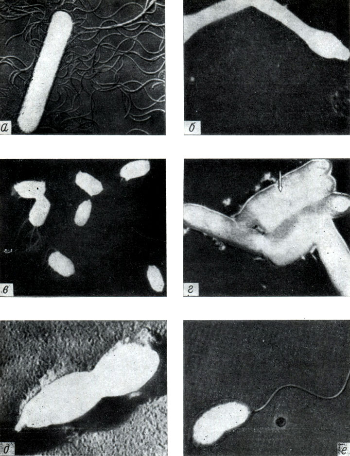  57.   .  -   Clostridium tetani;  -     . botulinum-,  -        ;  -   Mycobacterium tuberculosis (    );  -      Diplococcus pneumoniae;  -   Vibrio cholerae  
