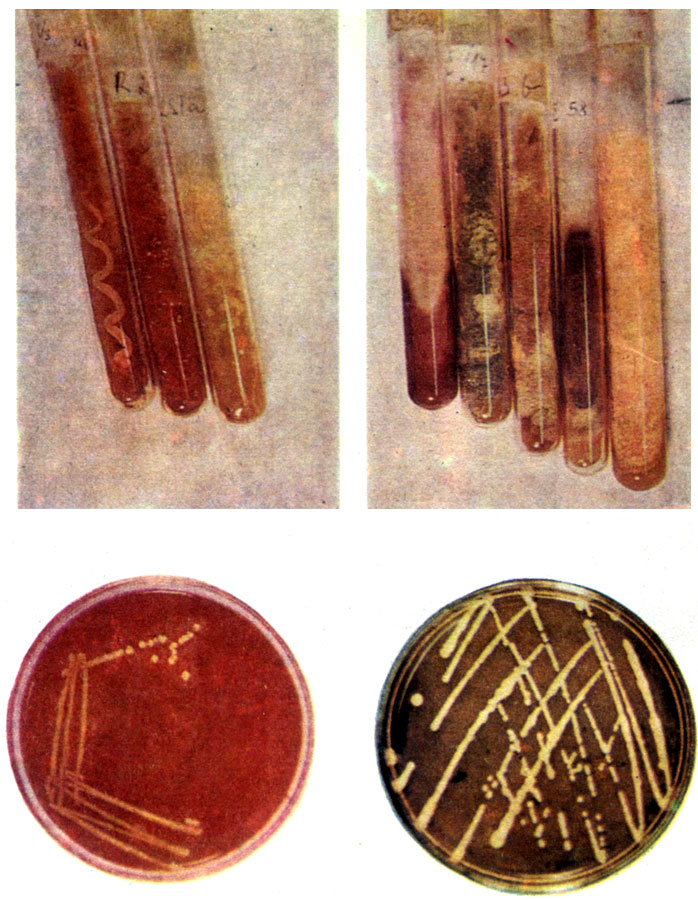 . IV.   . :  -  Saccharomyces cerevisiae, Rhodotorula glut inis   Staphylococcus aureus;  -    ,   . :  - Staphylococcus aureus   ;  - Saccharomyces cerevisiae   